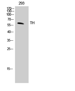 WB - TH Polyclonal Antibody AP72823